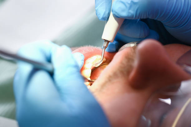 Best Emergency Treatment for Toothache in Smithers, WV